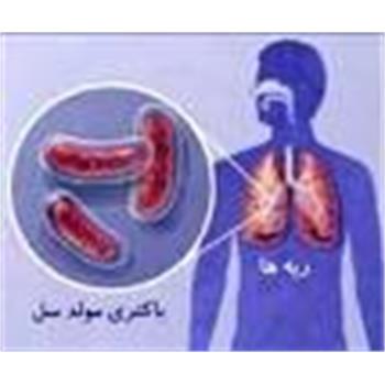 تمام اقدامات تشخیصی و درمانی سل در ایران رایگان است