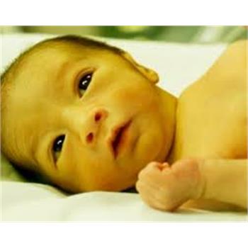 هوای خنک محیط و شیر دادن زیاد در جلوگیری از افزایش زردی نوزاد کمک کننده است