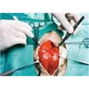 11 اردیبهشت : پخش آنلاین ( Web casting) عملی جراحی قلب ( CABG)