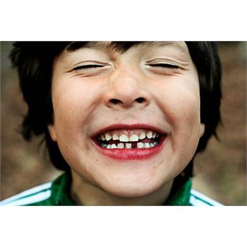 50 درصد از دانش آموزان کرمانشاهی در مقابل پوسیدگی دندان مقاوم شدند