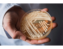 Scientists warn of deadly drug-resistant fungus spreading worldwide