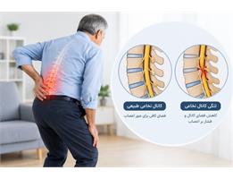 تنگی کانال در MRI همیشه به معنای ضرورت جراحی نیست!