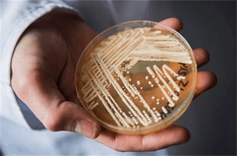 Scientists warn of deadly drug-resistant fungus spreading worldwide