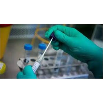 مراکز منتخب اعلام شده برای انجام واکسیناسیون بیماری کرونا در شهر کرمانشاه اعلام شد