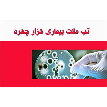 همه چیز درباره بیماری تب مالت