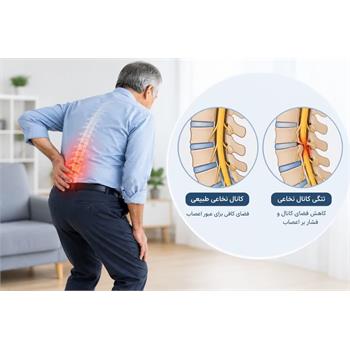 تنگی کانال در MRI همیشه به معنای ضرورت جراحی نیست!