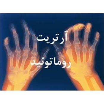 نکات قابل توجه برای بیماران ارتریت روماتویید( بخش ۳)