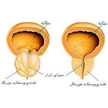 ویزیت رایگان به مناسبت هفته سلامت مردان