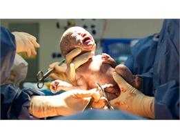 Unnecessary Cesarean Deliveries Threaten Mother and Baby’s Health