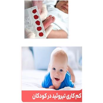 عقب ماندگی ذهنی, ۸۹۲ نوزاد کرمانشاه, کم کاری تیروئید