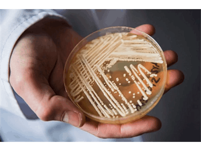 Scientists warn of deadly drug-resistant fungus spreading worldwide