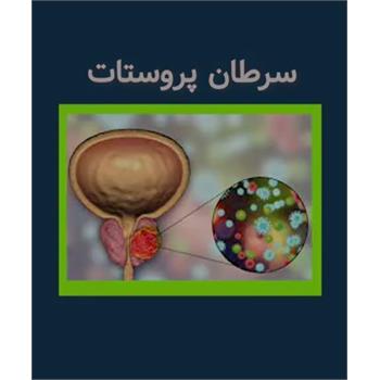 سرطان پروستات/ عوامل خطر، علائم، تشخیص، درمان، بیماریابی و پیشگیری