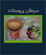 سرطان پروستات/ عوامل خطر، علائم، تشخیص، درمان، بیماریابی و پیشگیری