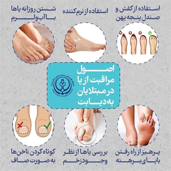 اصول مراقبت از پا بیماران دیابتی