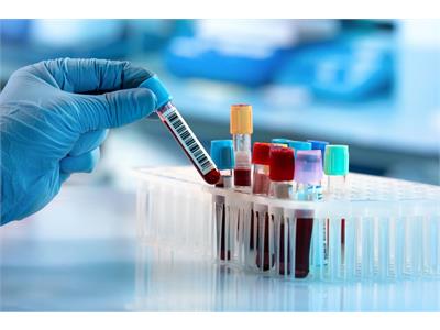 KUMS Opens Applications for PhD by Research Programs