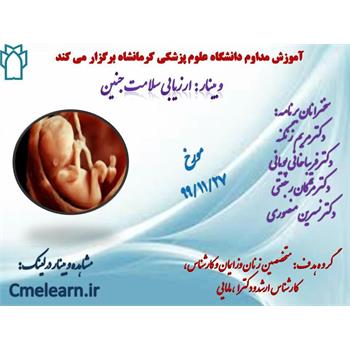 وبینار ارزیابی سلامت جنین برگزار می شود
