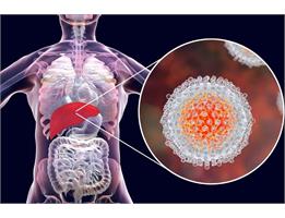 Steps Toward Eliminating Hepatitis C: Public Awareness and Early Diagnosis Are Key