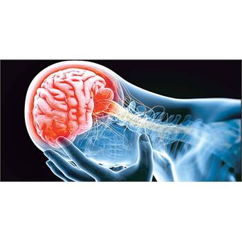 مراجعه دیرهنگام و محرومیت از درمان‌ علت اصلی سکته مغزی