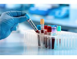KUMS Opens Applications for PhD by Research Programs