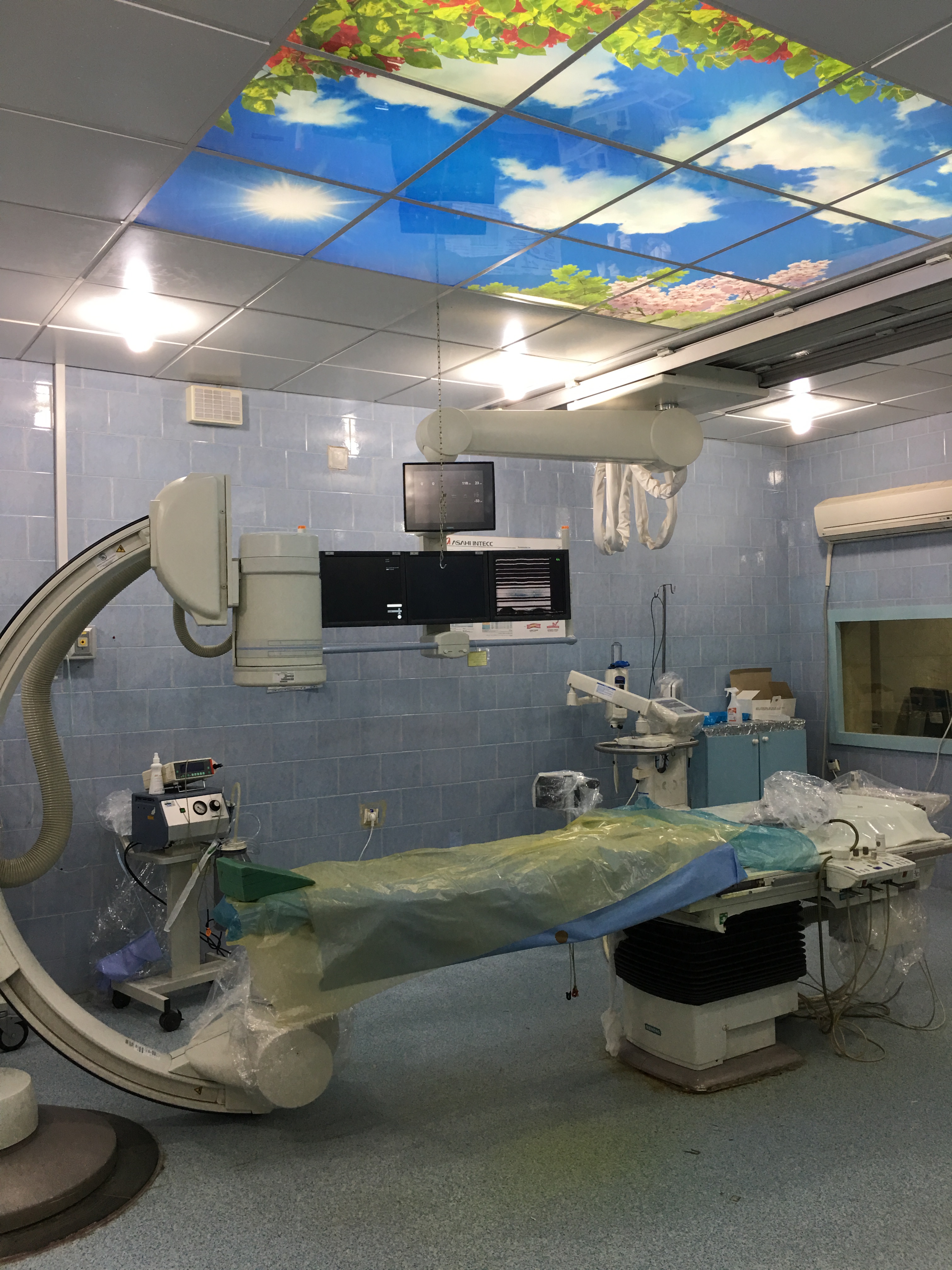 آنژیو گرافی