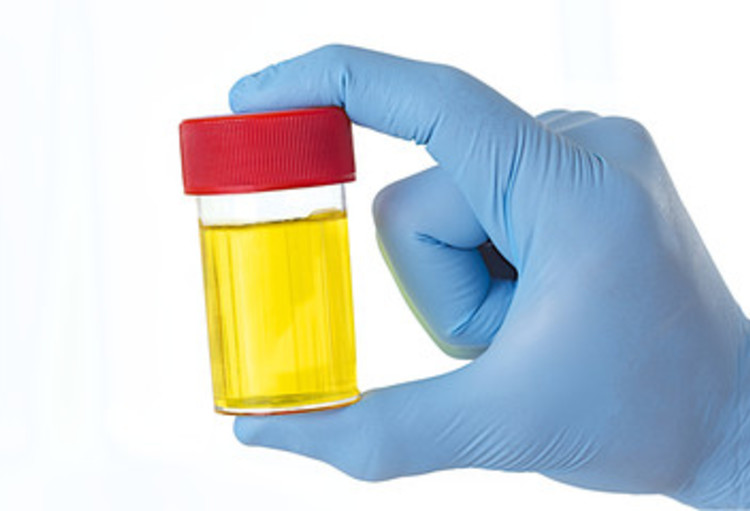 آزمایشات ازدواجی، استخدامی و اپیوم