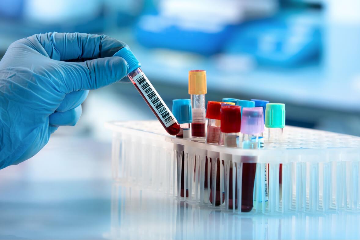 KUMS Opens Applications for PhD by Research Programs